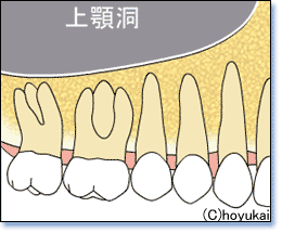 TCiXtg1